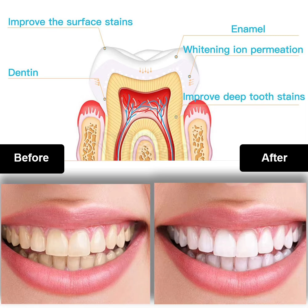 Dental Teeth Whitening Kit Mini 16 LED Cold Light 35% Carbamide Peroxide Gel Tooth Whitener Bleaching Pen Oral Tray Device Set